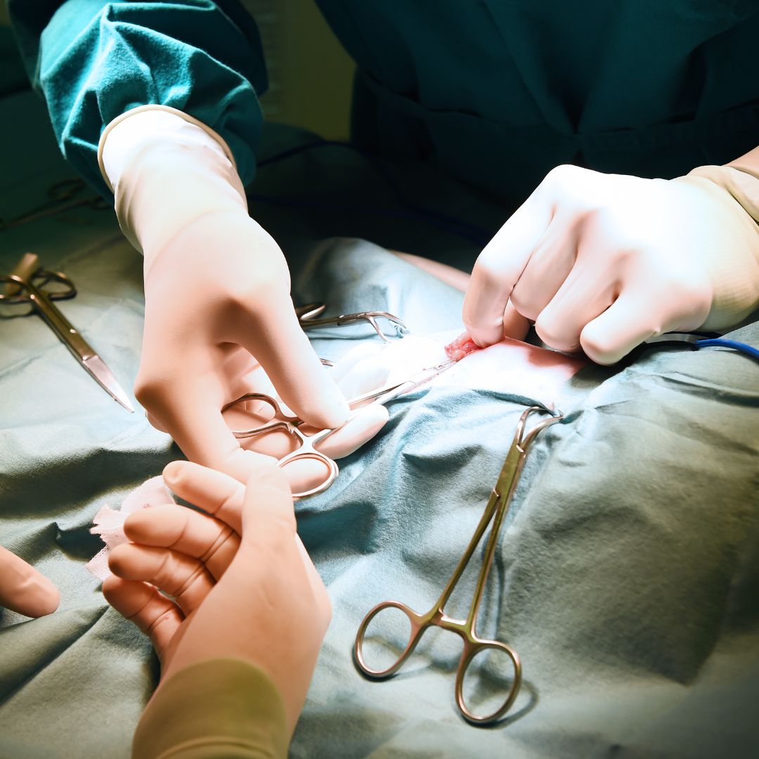 How Female Surgery Is Beneficial?
