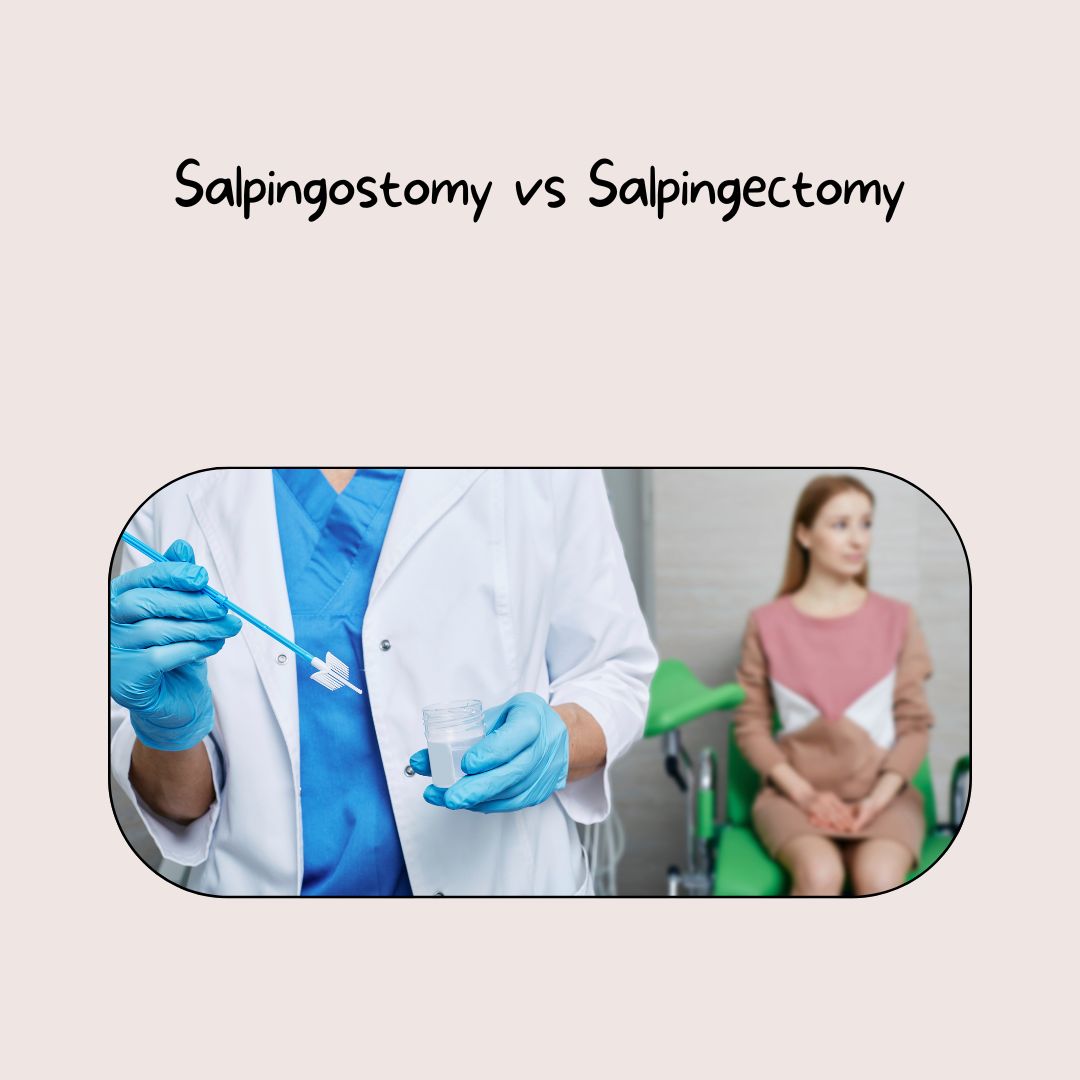 Salpingostomy vs Salpingectomy