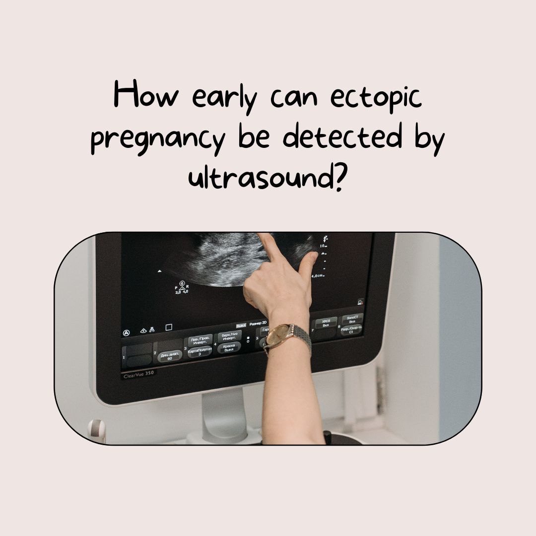 How early can ectopic pregnancy be detected by ultrasound?