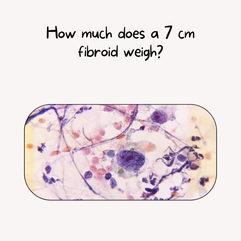 How much does a 7 cm fibroid weigh?