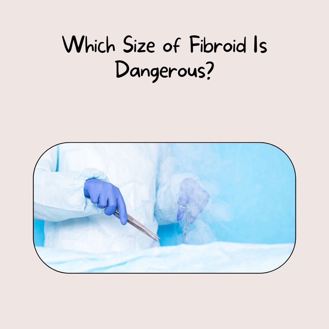 Which Size of Fibroid Is Dangerous?