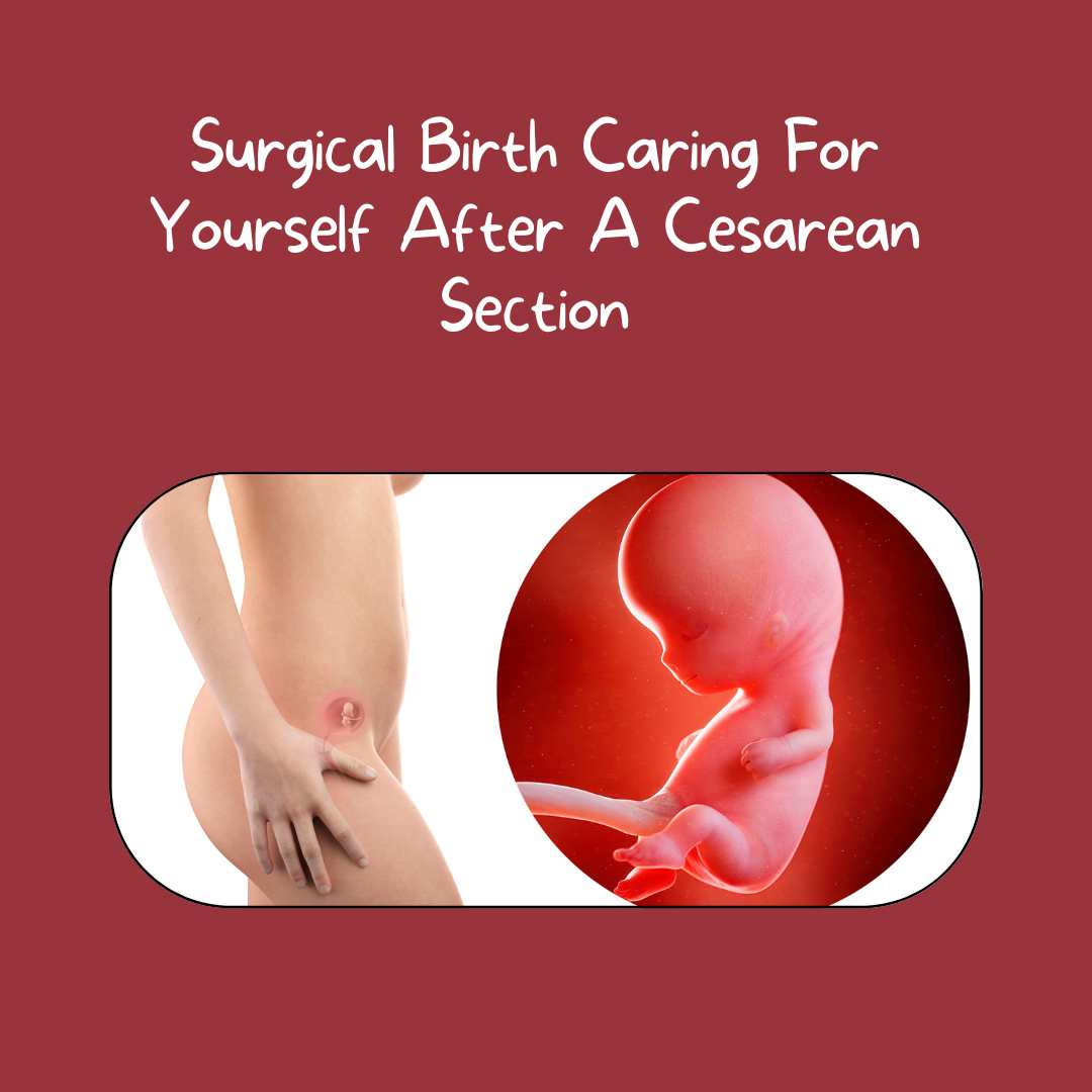 Cesarean Section When Is It Necessary and What to Expect