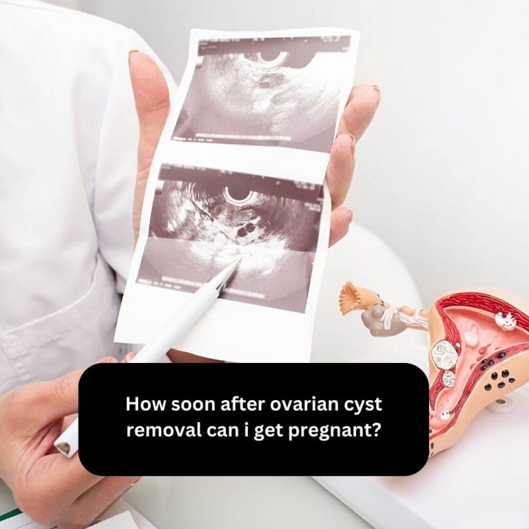 How soon after ovarian cyst removal can i get pregnant?